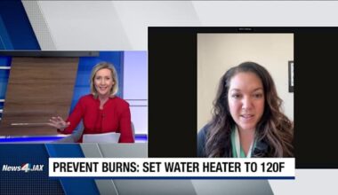 Doctor explains common household burn causes, prevention tips for parents