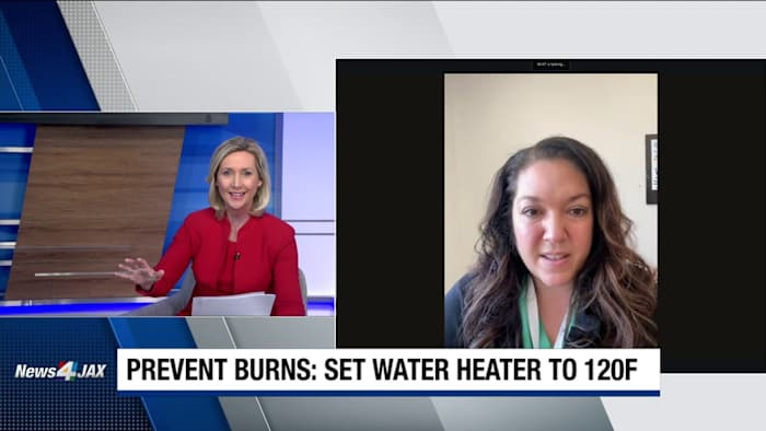 Doctor explains common household burn causes, prevention tips for parents