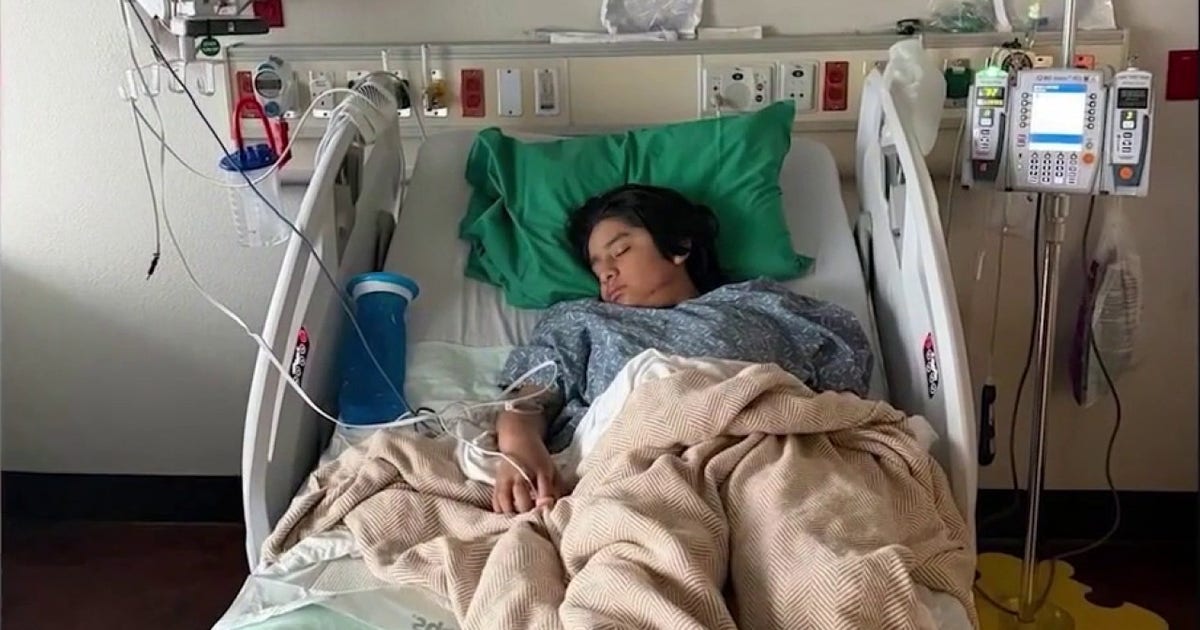 Ocoee teen recovers, family seeks answers after caught-on-camera hit-and-run