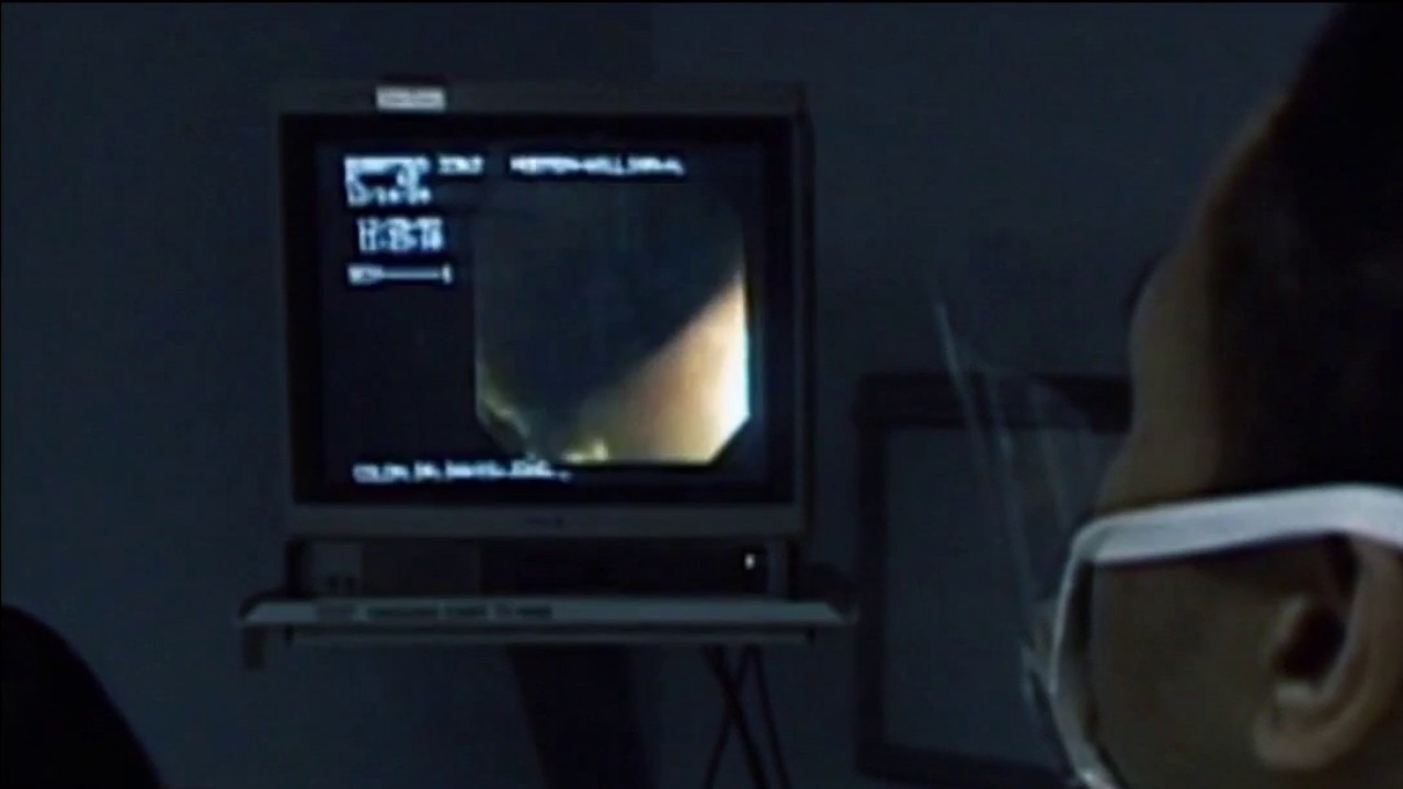 Importance of colorectal cancer screening