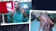 Photos obtained by NBC6 show the officer with bloody bruises on his knuckles.
