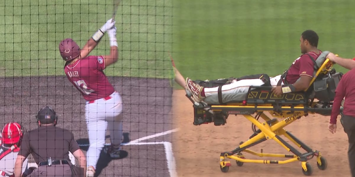 Myles Bailey undergoes surgery, out for the season