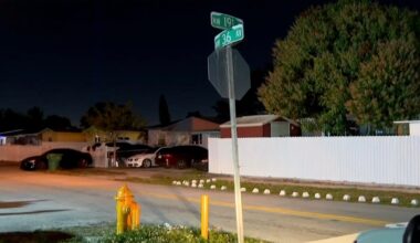 2-year-old boy bitten in face by two pit bulls in Miami Gardens backyard, police say