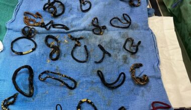 Look: Florida cat gets surgery after swallowing 26 hair ties