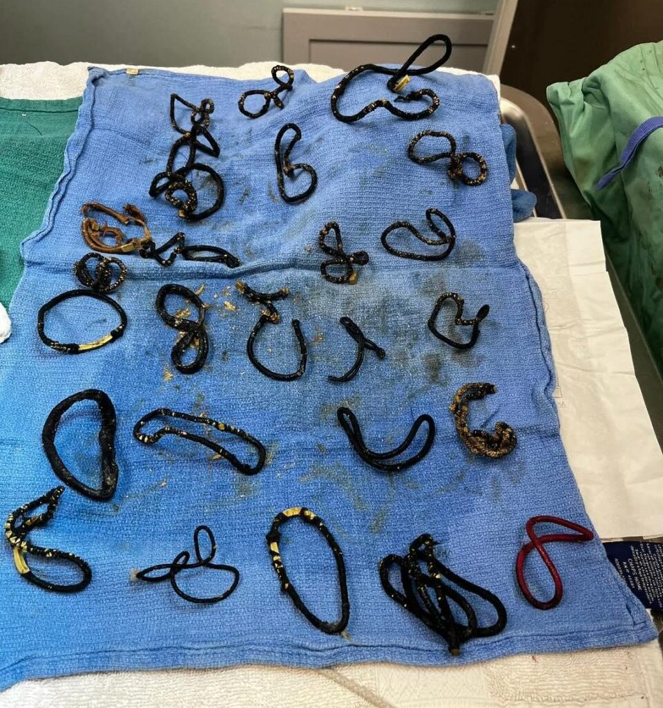Look: Florida cat gets surgery after swallowing 26 hair ties