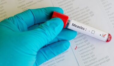 First measles case of 2026 reported in Central Florida – WFTV