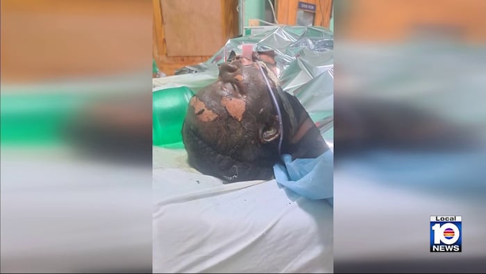 Jamaica gas station attack leaves woman critically burned, fundraiser launched for airlift