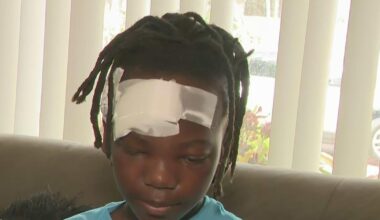 11-year-old boy recounts being hit by a speeding car while walking to school in Miami Gardens