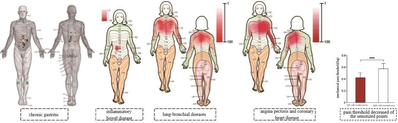 How acupoints being sensitized and play for diseases diagnosis and treatment