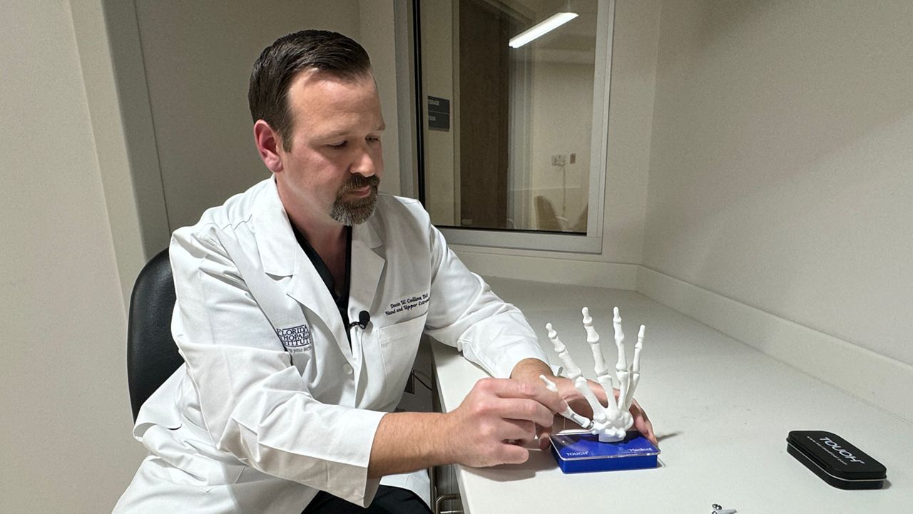 Florida Orthopaedic Institute's thumb prosthesis surgery