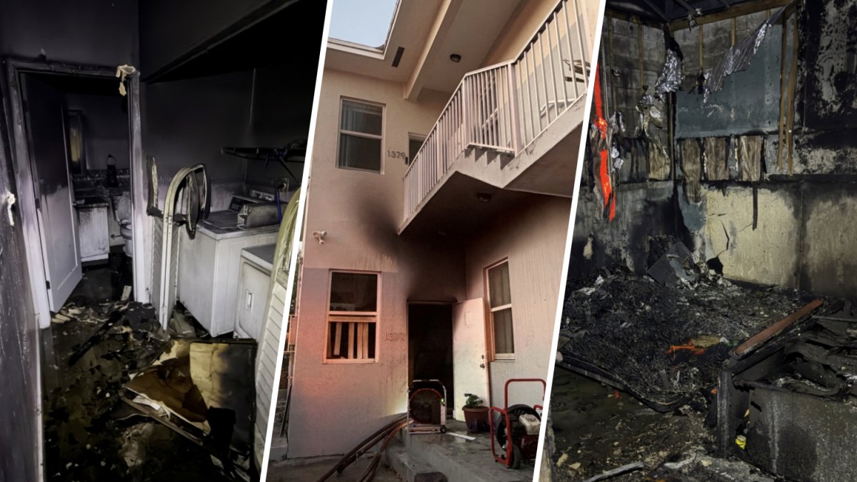 Man suffers 3rd-degree burns after cigarette sparks explosion in Liberty City – NBC 6 South Florida