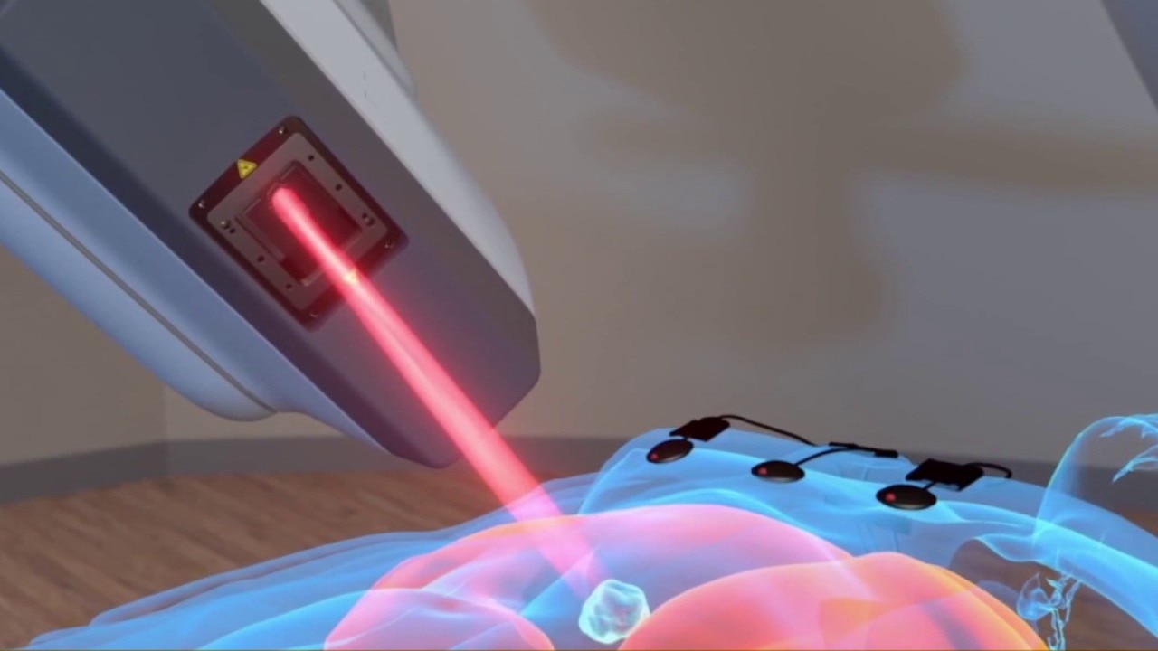 Hospitals team up with A.I. technology