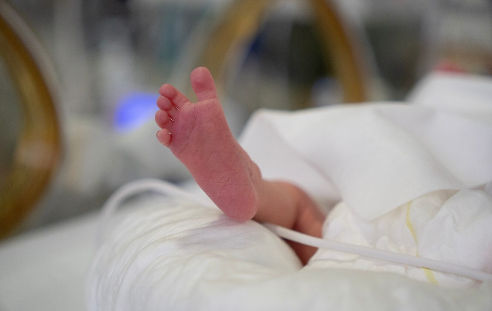 Florida must act to curb rising preterm birth crisis