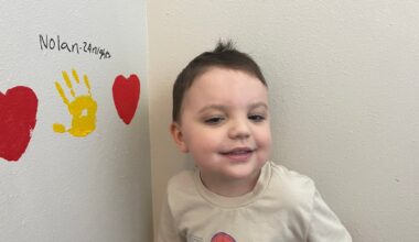 Law student donates part of her liver to 4-year-old