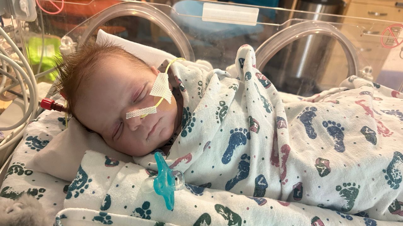 Axl went into a coma because his little body was filling with ammonia — 100 times more than a normal amount. (Family photo)