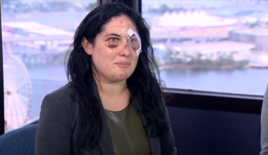 Woman describes terrifying moments after being beaten, stabbed by pen in downtown Miami - WSVN 7News | Miami News, Weather, Sports