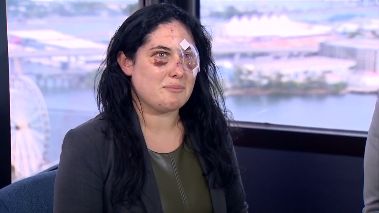 Woman describes terrifying moments after being beaten, stabbed by pen in downtown Miami - WSVN 7News | Miami News, Weather, Sports