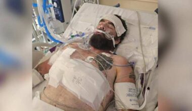 Man seriously injured in Butler Beach road rage shooting describes harrowing encounter, shares warning for other drivers