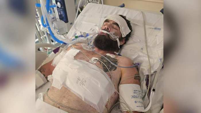 Man seriously injured in Butler Beach road rage shooting describes harrowing encounter, shares warning for other drivers