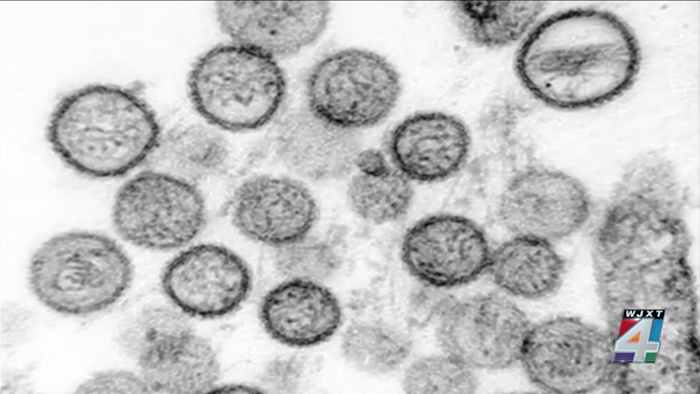 Hantavirus is rare, but here’s what you need to know