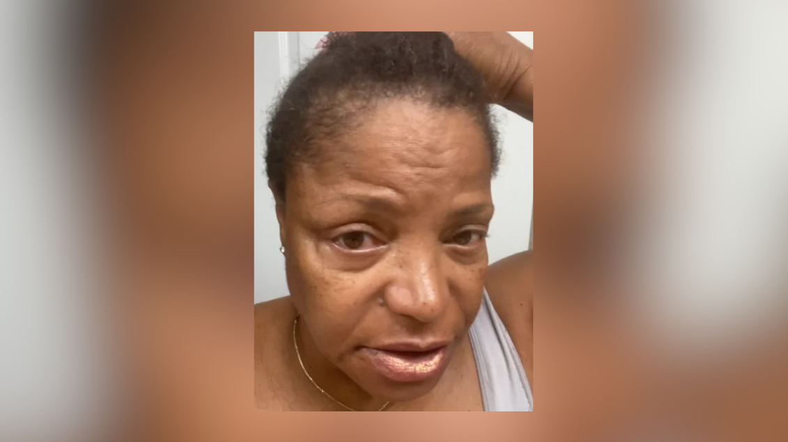 Kathy Monroe says her hair was permanently damaged by incident