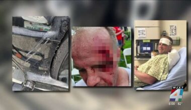 Orlando bicyclist recovering after getting hit by truck during IRONMAN Jacksonville
