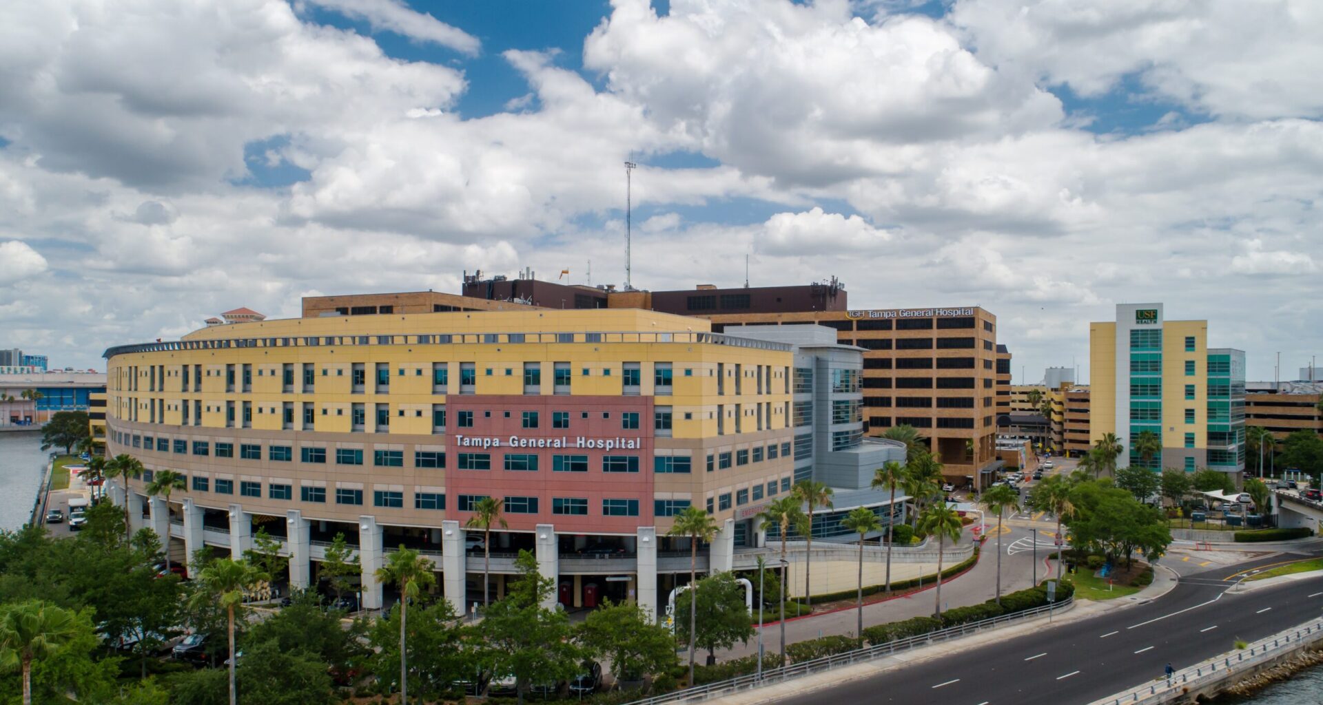 Tampa General uses 3D printing in heart procedures