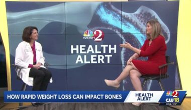 Orlando doctor discusses how rapid weight loss can negatively impact bone density