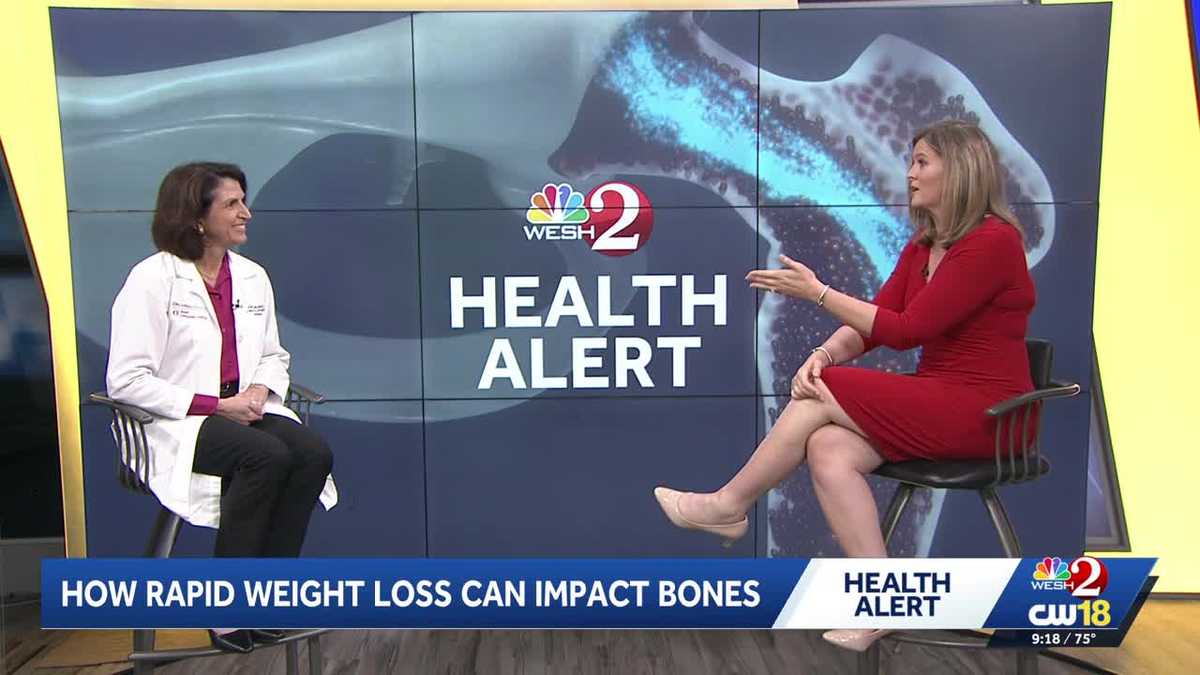 Orlando doctor discusses how rapid weight loss can negatively impact bone density