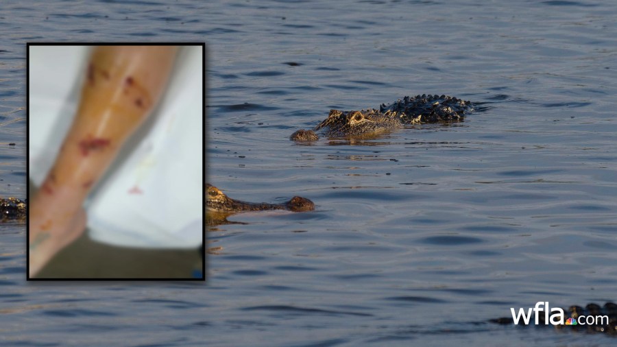 Florida officials continue search for alligator that attacked woman in Inverness
