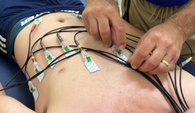 Florida law to require heart screenings for student athletes