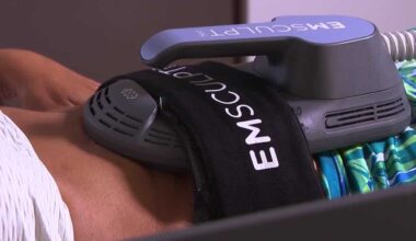 Emsculpt Neo treatments gain popularity at Cape Coral med spa for fat reduction and toning