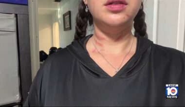 ‘My child was watching me get attacked,’ mom says after couple accused of assaulting her in Davie