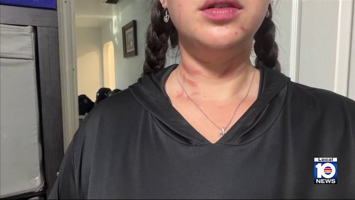 ‘My child was watching me get attacked,’ mom says after couple accused of assaulting her in Davie