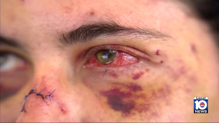 ‘I was fighting for my life’: Woman describes homeless man’s brutal attack in downtown Miami