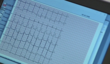 BayCare, Florida nonprofit offers heart screenings ahead of new ECG law for first-time high school athletes