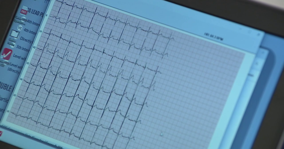 BayCare, Florida nonprofit offers heart screenings ahead of new ECG law for first-time high school athletes