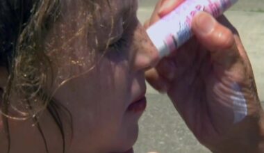 Is your sunscreen safe? What doctors say about the new EWG rankings