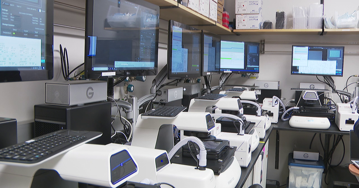 Moffitt Cancer Center tests AI tool for treatments, building personalized care for rare cancer