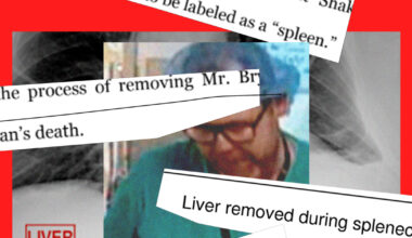 A trail of errors: How a Florida surgeon removed a patient’s liver by mistake