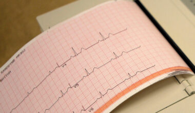 Florida’s universal EKG law for high school athletes is a mistake