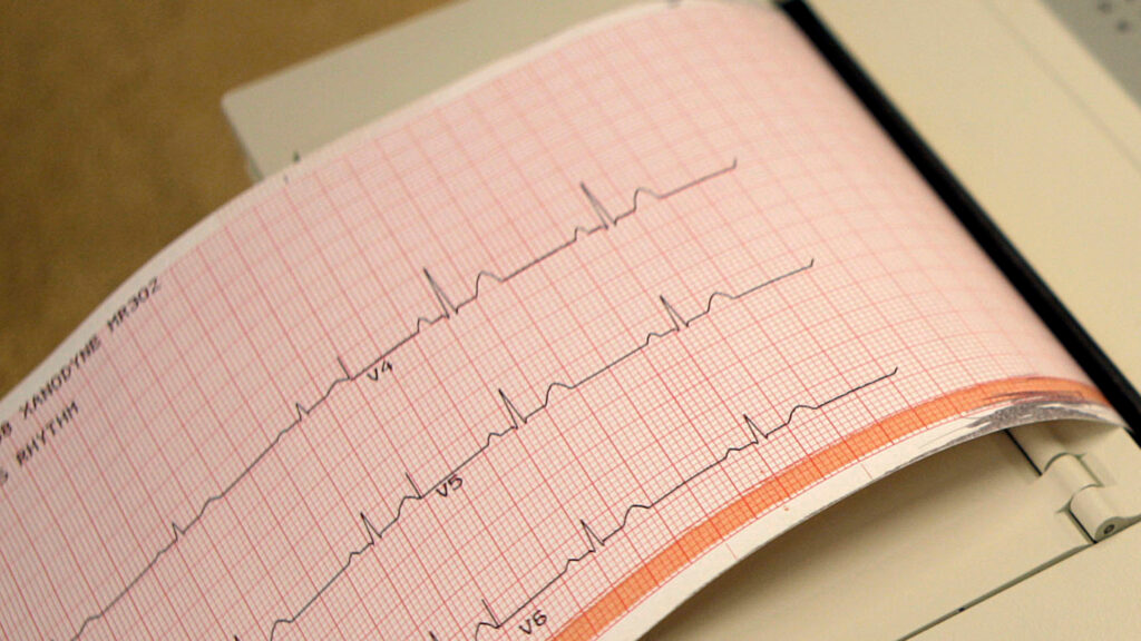 Florida’s universal EKG law for high school athletes is a mistake