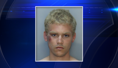 Miami Beach burglary suspect found naked inside apartment, accused of injuring detective during arrest - WSVN 7News | Miami News, Weather, Sports