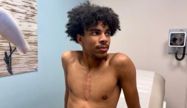 Florida's student-athlete ECG law takes effect July 1