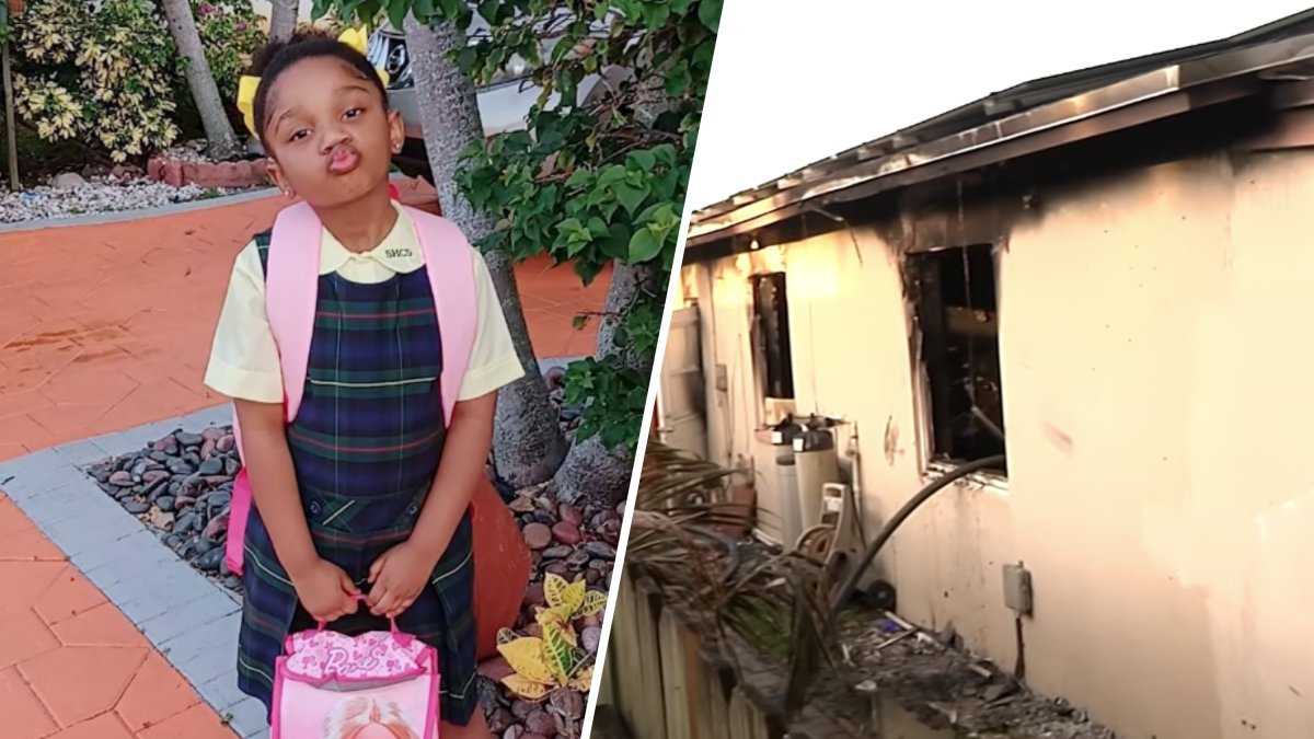 North Lauderdale house fire leaves 6-year-old on ventilator – NBC 6 South Florida