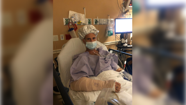 Florida man recalls 2020 alligator attack that tore off his arm