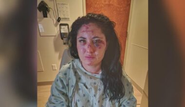 Downtown Miami assault survivor pushes for safety measures after random attack