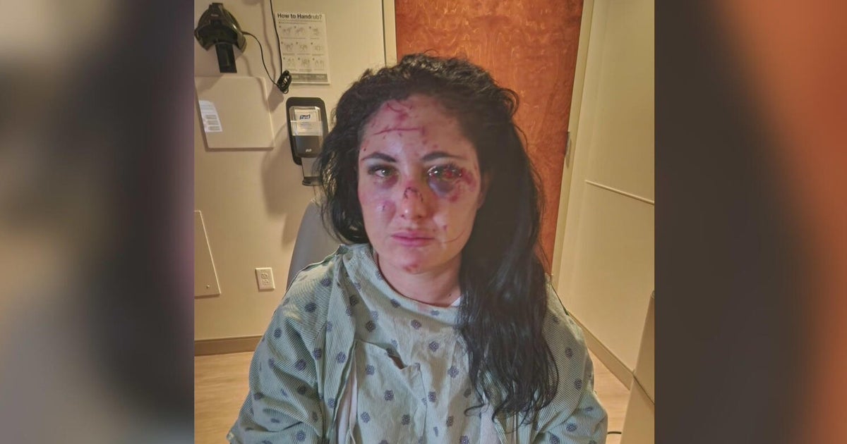 Downtown Miami assault survivor pushes for safety measures after random attack