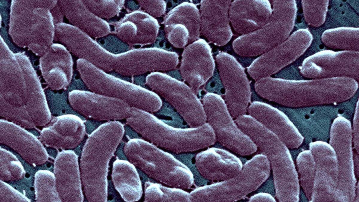 Rare flesh-eating bacteria has been detected in Miami-Dade