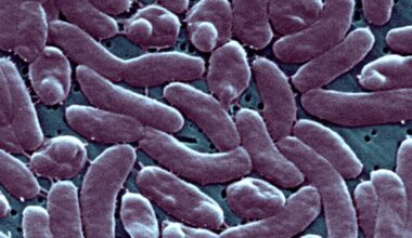 Rare, flesh-eating bacteria found in Florida including Miami-Dade, state health officials say
